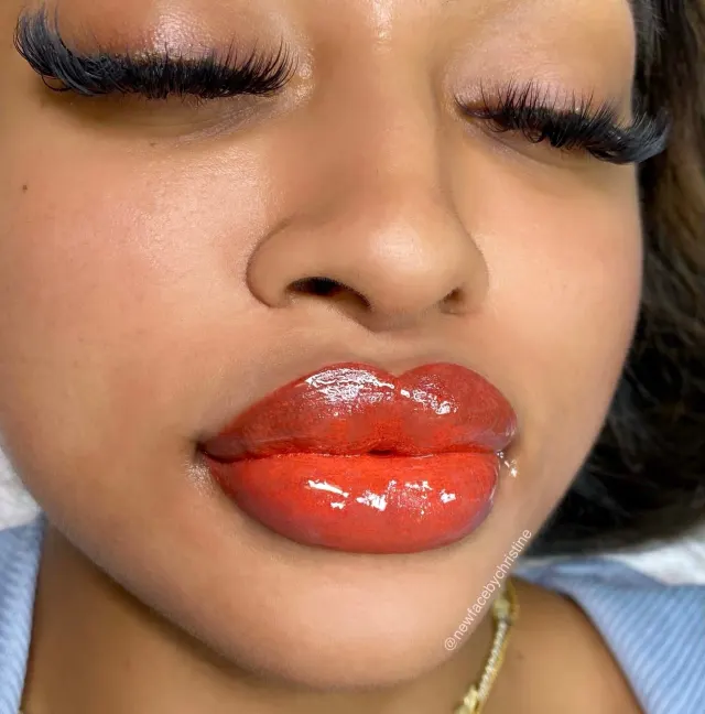 Dark Lips Neutralization result by New Face by Christine, NYC — photo 173