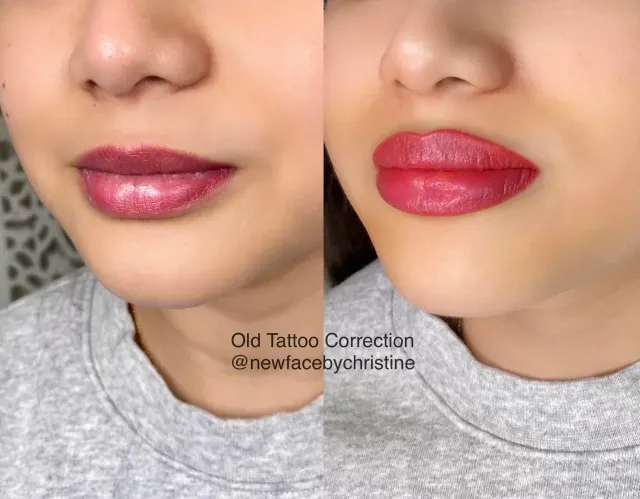 Dark Lips Neutralization result by New Face by Christine, NYC — photo 192