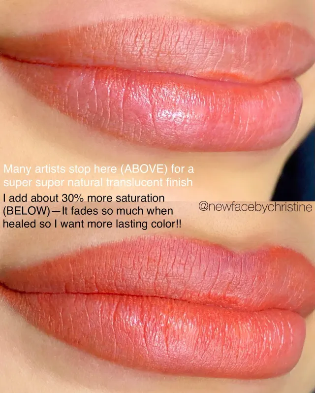 Dark Lips Neutralization result by New Face by Christine, NYC — photo 195