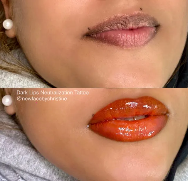 Dark Lips Neutralization result by New Face by Christine, NYC — photo 198