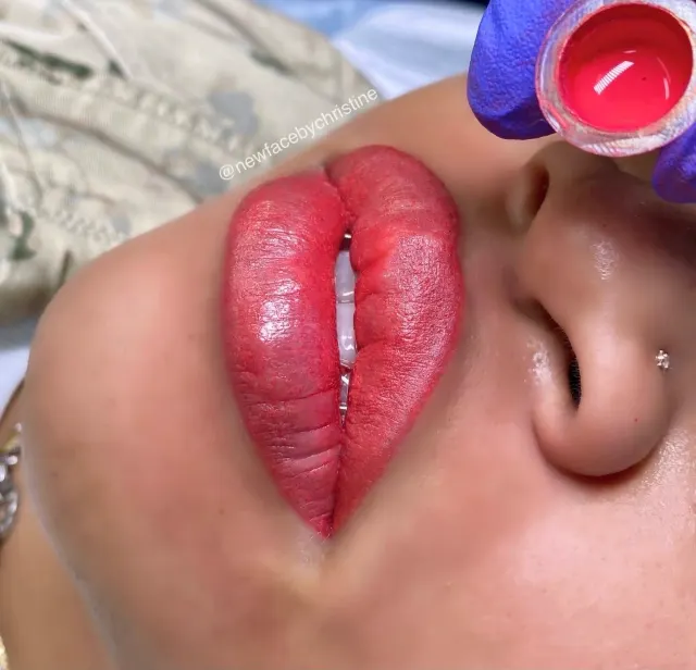 Dark Lips Neutralization result by New Face by Christine, NYC — photo 199
