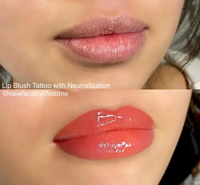 Dark Lips Neutralization result by New Face by Christine, NYC — photo 205