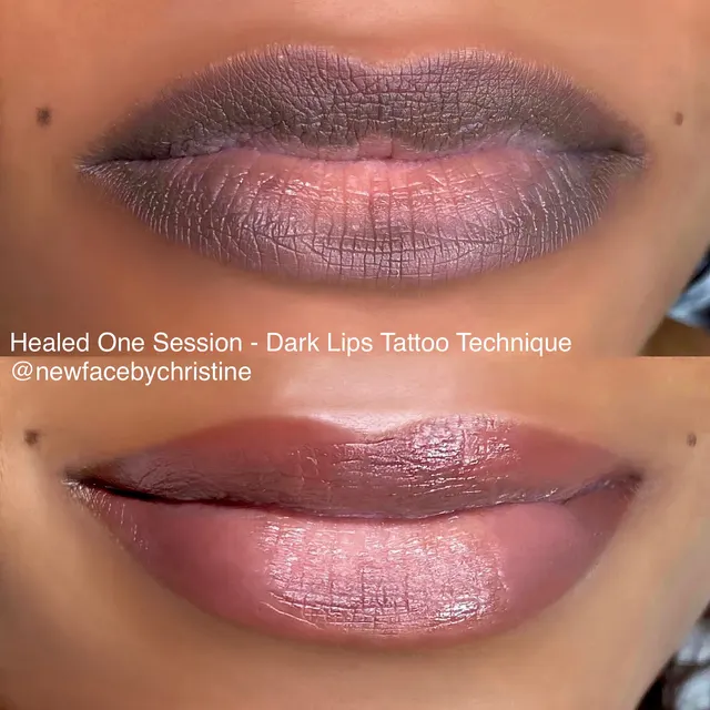 Dark Lips Neutralization result by New Face by Christine, NYC — photo 209
