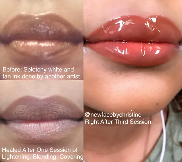 Dark Lips Neutralization result by New Face by Christine, NYC — photo 213