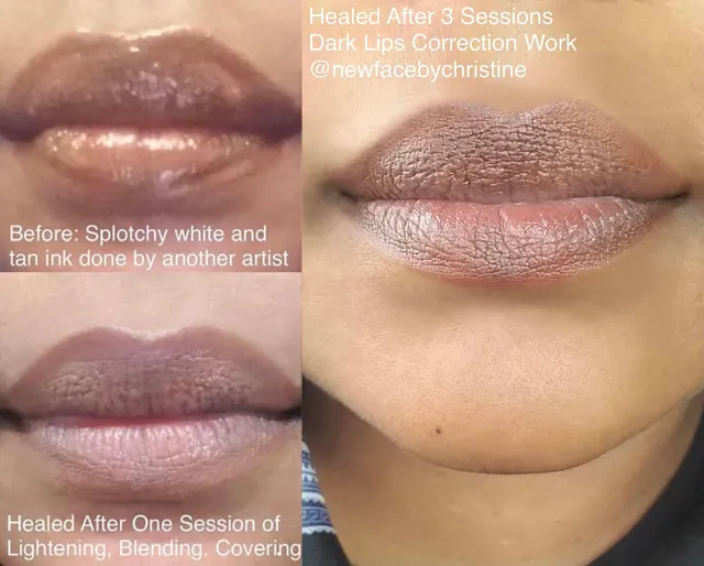 Dark Lips Neutralization result by New Face by Christine, NYC — photo 214