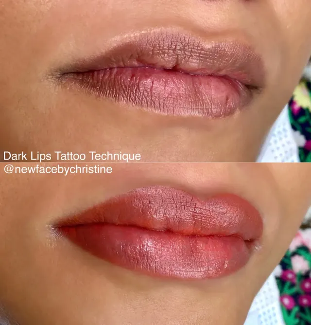 Dark Lips Neutralization result by New Face by Christine, NYC — photo 216
