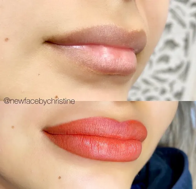 Dark Lips Neutralization result by New Face by Christine, NYC — photo 222