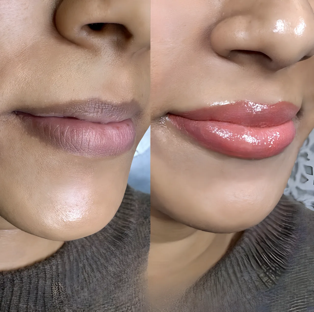 Healed dark lips neutralization by Christine