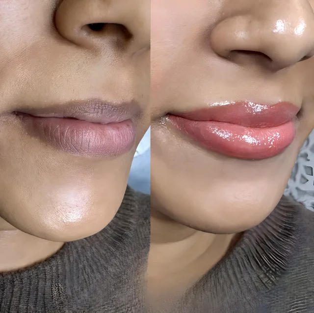 Dark Lips Neutralization by New Face by Christine
