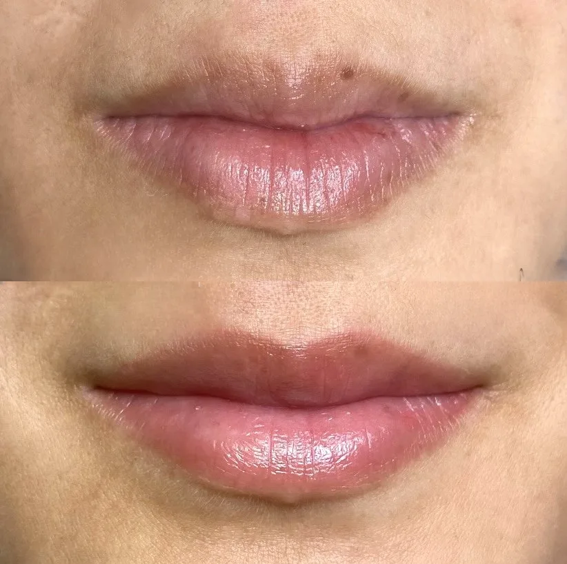 Dark Lips Neutralization by New Face by Christine