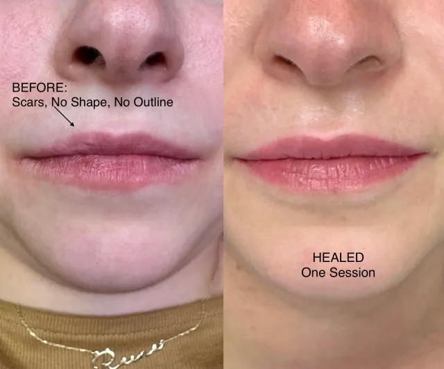 Lip Blush Tattoo result by New Face by Christine, NYC — photo 9