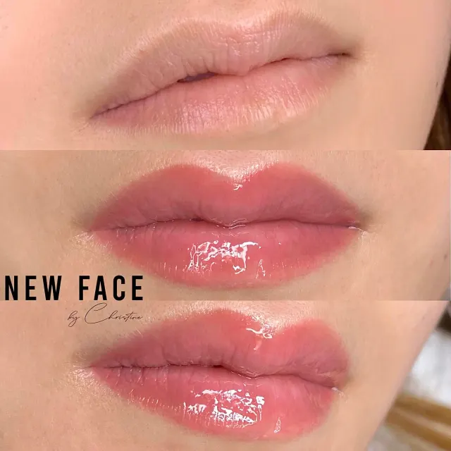 Lip Blush Tattoo result by New Face by Christine, NYC — photo 13