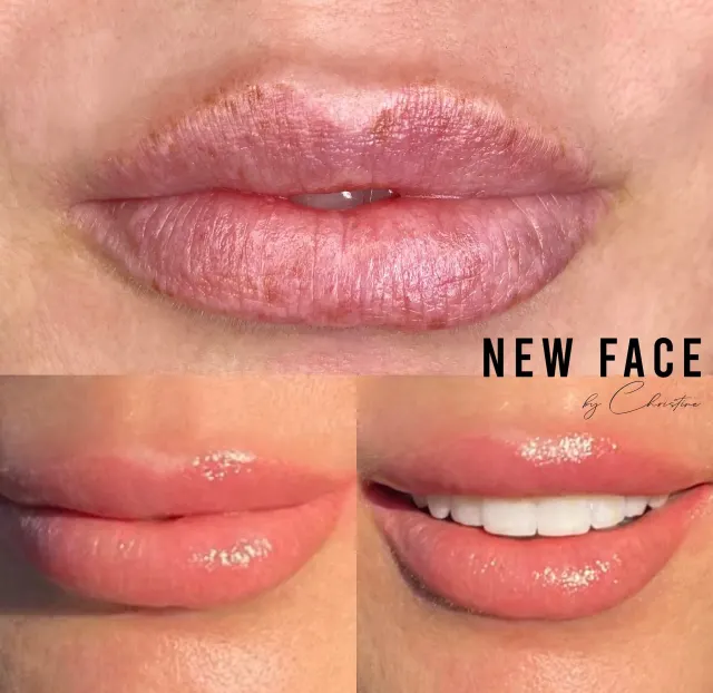 Lip Blush Tattoo result by New Face by Christine, NYC — photo 14