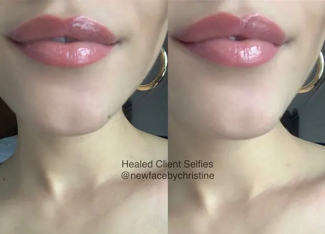 Lip Blush Tattoo result by New Face by Christine, NYC — photo 16