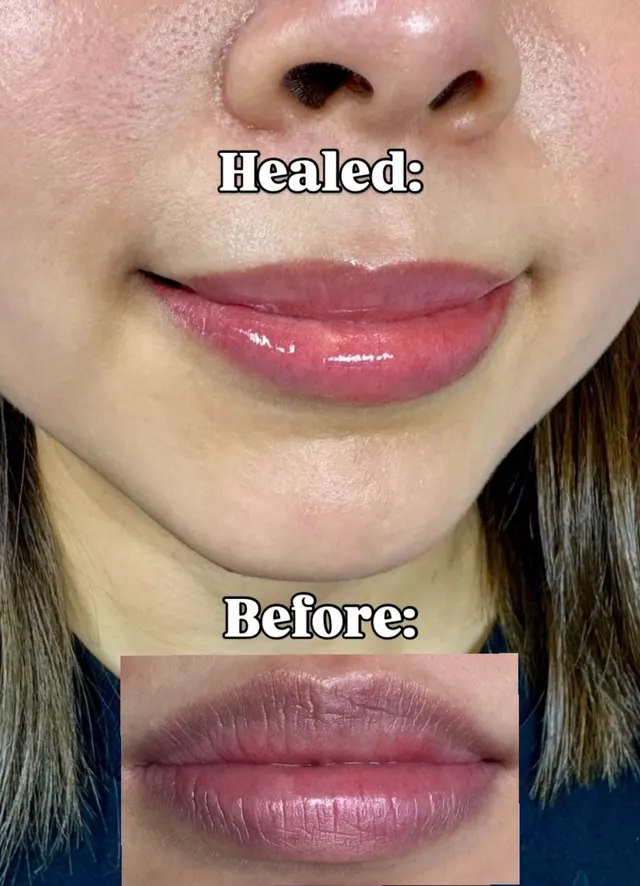 Lip Blush Tattoo result by New Face by Christine, NYC — photo 17