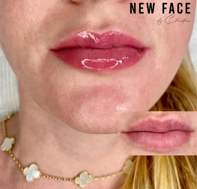 Lip Blush Tattoo result by New Face by Christine, NYC — photo 18
