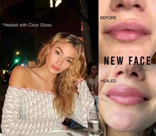Lip Blush Tattoo result by New Face by Christine, NYC — photo 30