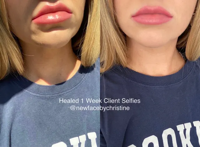 Lip Blush Tattoo result by New Face by Christine, NYC — photo 40