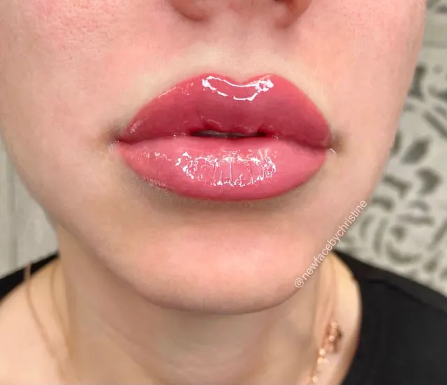 Lip Blush Tattoo result by New Face by Christine, NYC — photo 67