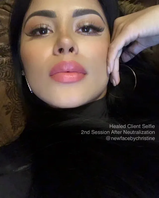 Lip Blush Tattoo result by New Face by Christine, NYC — photo 69