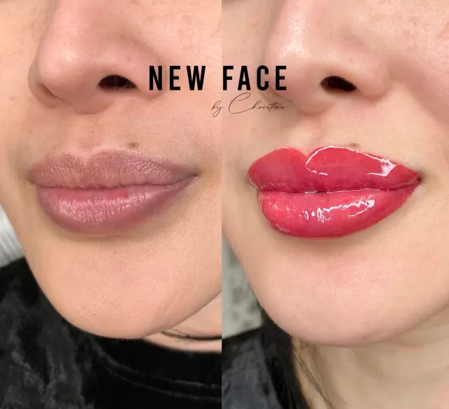 Lip Blush Tattoo result by New Face by Christine, NYC — photo 71
