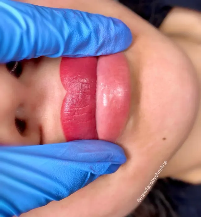 Lip Blush Tattoo result by New Face by Christine, NYC — photo 84