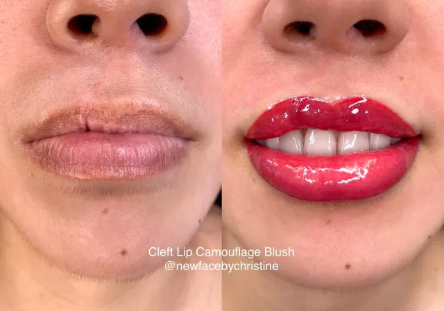 Lip Blush Tattoo result by New Face by Christine, NYC — photo 96