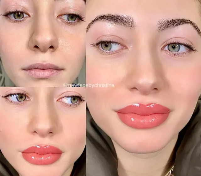 Lip Blush Tattoo result by New Face by Christine, NYC — photo 107