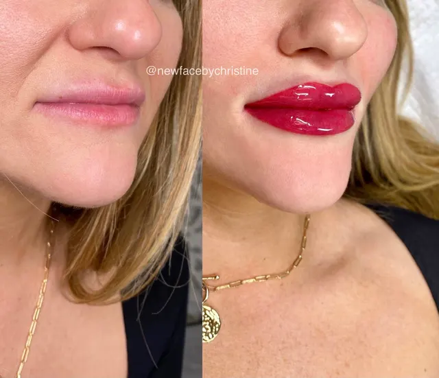 Lip Blush Tattoo result by New Face by Christine, NYC — photo 110