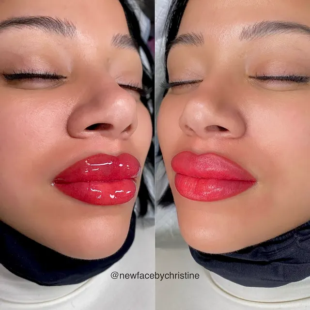 Lip Blush Tattoo result by New Face by Christine, NYC — photo 123