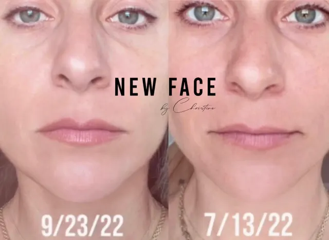 Lip Blush Tattoo result by New Face by Christine, NYC — photo 131