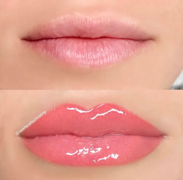 Lip Blush Tattoo result by New Face by Christine, NYC — photo 141