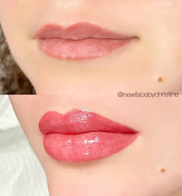 Lip Blush Tattoo result by New Face by Christine, NYC — photo 147