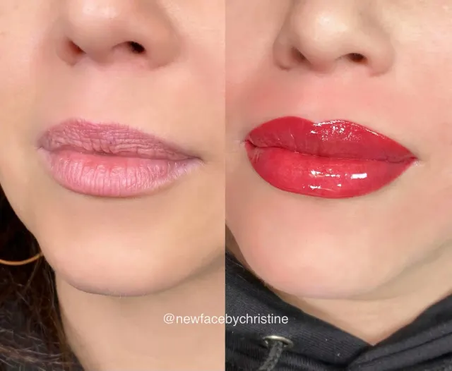 Lip Blush Tattoo result by New Face by Christine, NYC — photo 160