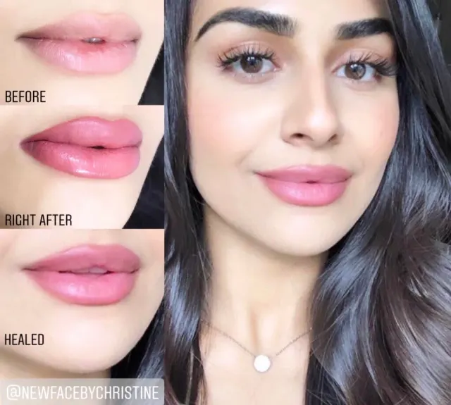 Lip Blush Tattoo result by New Face by Christine, NYC — photo 171