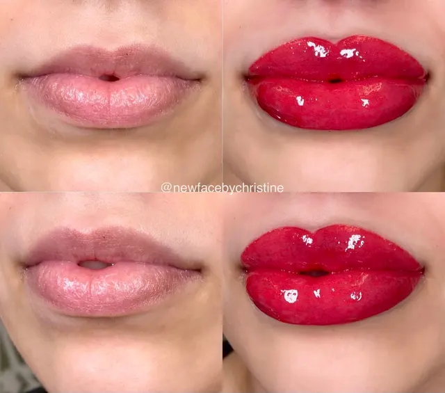 Lip Blush Tattoo result by New Face by Christine, NYC — photo 177