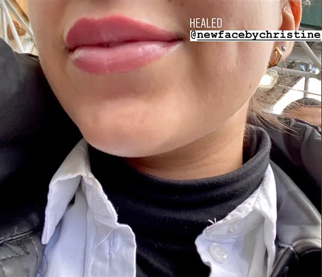 Lip Blush Tattoo result by New Face by Christine, NYC — photo 193