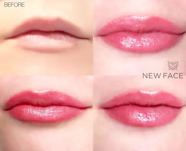 Lip Blush Tattoo result by New Face by Christine, NYC — photo 218