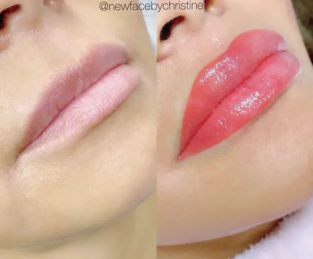 Lip Blush Tattoo result by New Face by Christine, NYC — photo 220