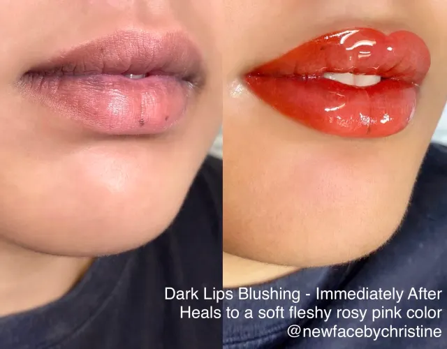 Lip Blush Tattoo result by New Face by Christine, NYC — photo 221