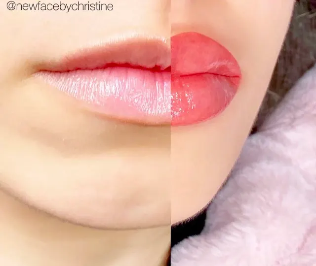 Lip Blush Tattoo result by New Face by Christine, NYC — photo 224