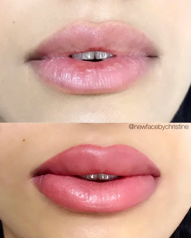 Lip Blush Tattoo result by New Face by Christine, NYC — photo 226