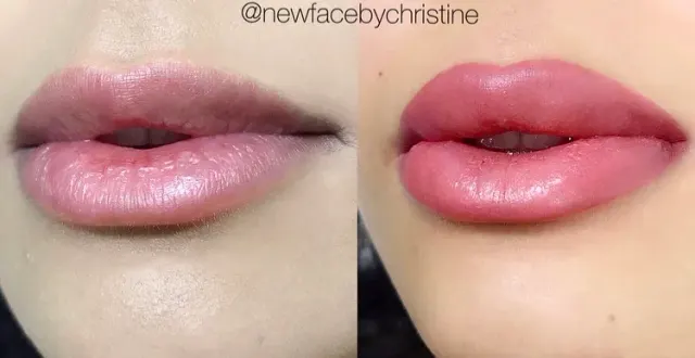 Lip Blush Tattoo result by New Face by Christine, NYC — photo 227