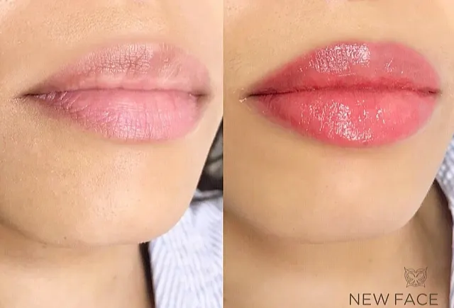 Lip Blush Tattoo result by New Face by Christine, NYC — photo 237