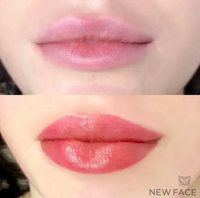 Lip Blush Tattoo result by New Face by Christine, NYC — photo 240