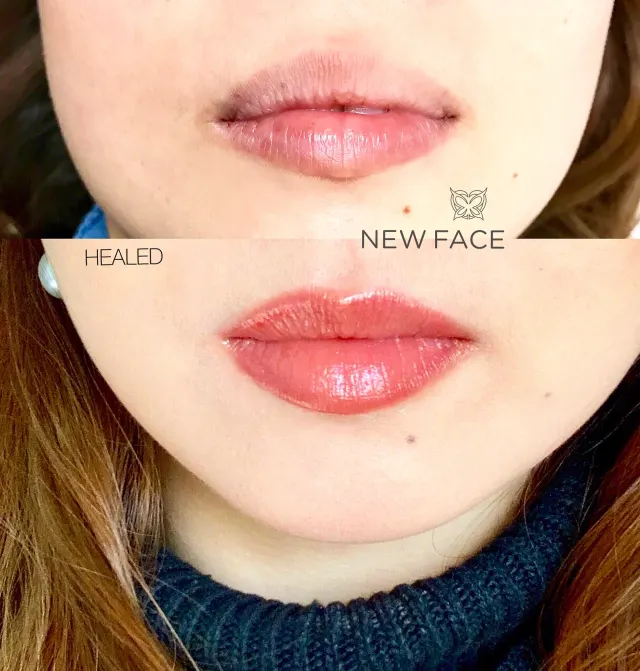 Lip Blush Tattoo result by New Face by Christine, NYC — photo 242