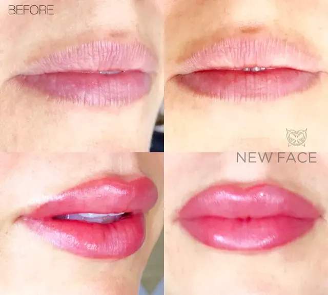 Lip Blush Tattoo result by New Face by Christine, NYC — photo 243