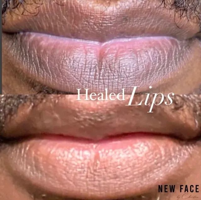Men's Lips & Brows result by New Face by Christine, NYC — photo 2